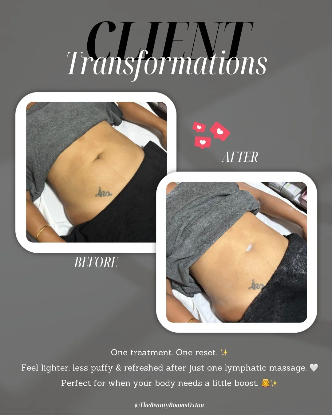 One treatment can make a difference ✨

A little less puffiness, a more defined look &amp; that instantly lighter feeling 🤍

Our lymphatic massage is the perfect reset for when your body needs a little extra TLC. ✨

Ready for your reset? DM us to boo