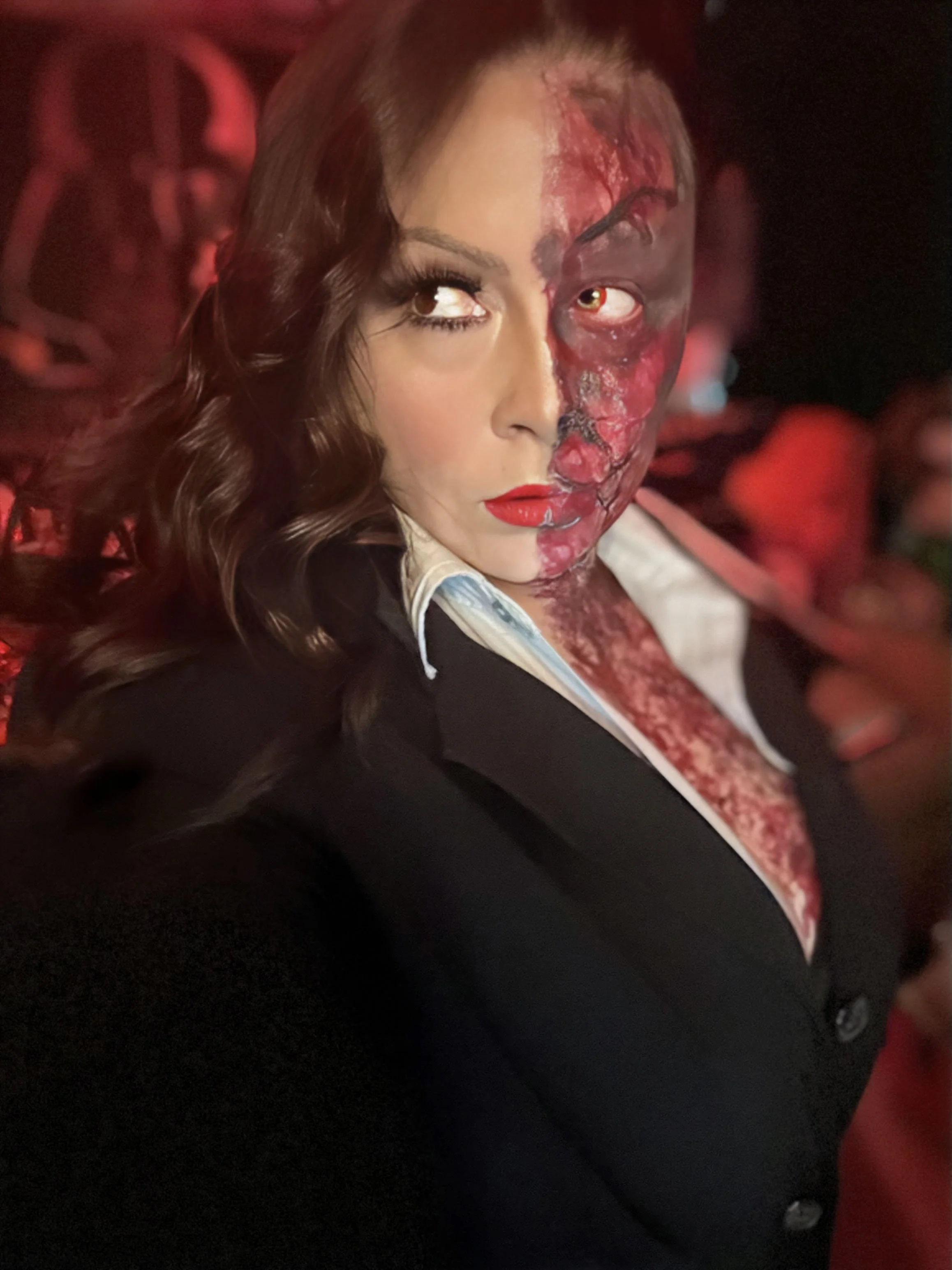 Woman with long brown hair and makeup, wearing a business suit, with half of her face showing burn scars and injuries.