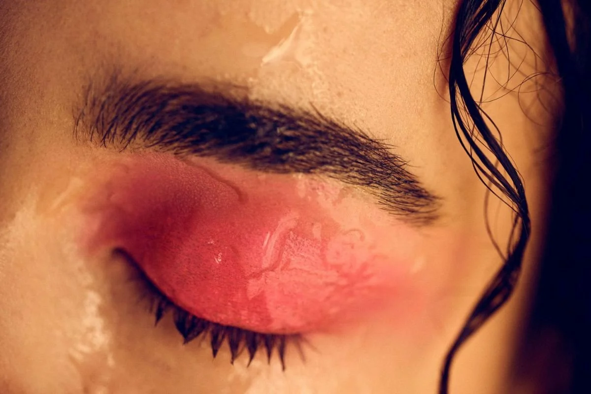 Inflammation and dehydration contributing to dull skin appearance