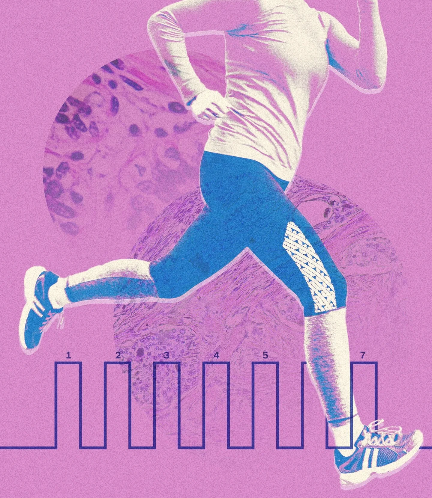 HIIT and Its Impact on Cancer