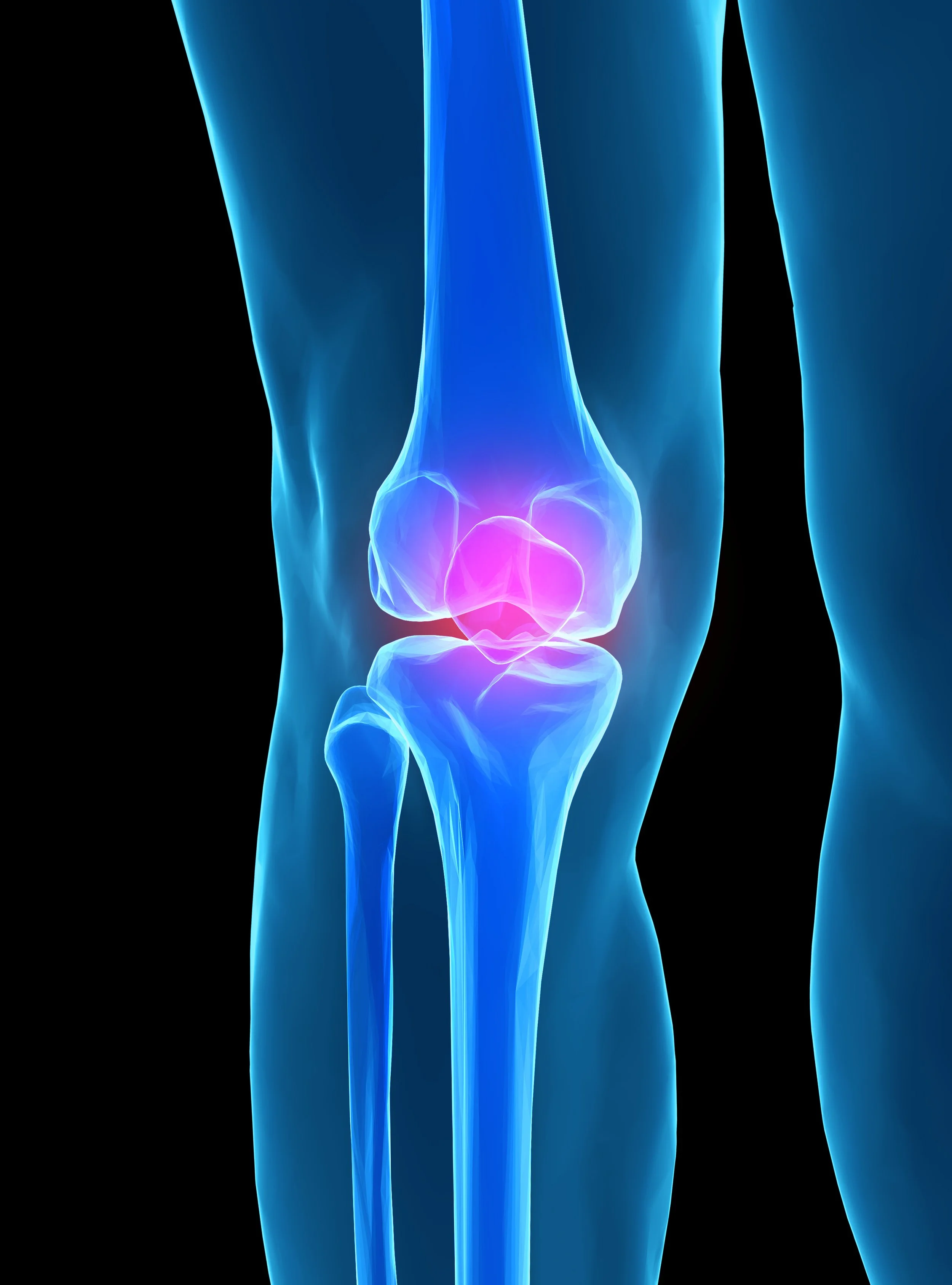 Chronic knee pain.