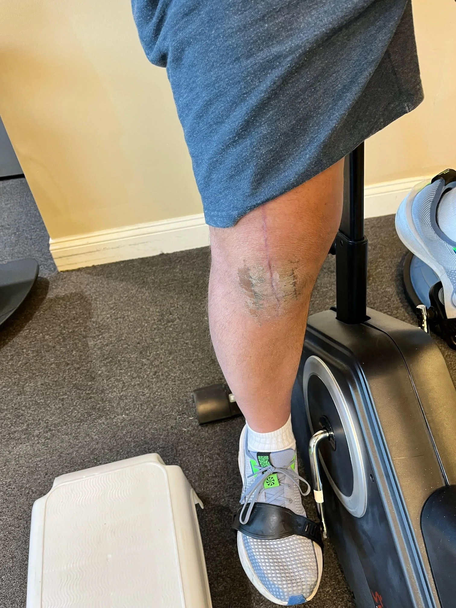 Prepare for your visit with our physical therapist for your knee surgery pain and healing. Patients, knee straight, knee bent, knees bent, upper body, overall health.