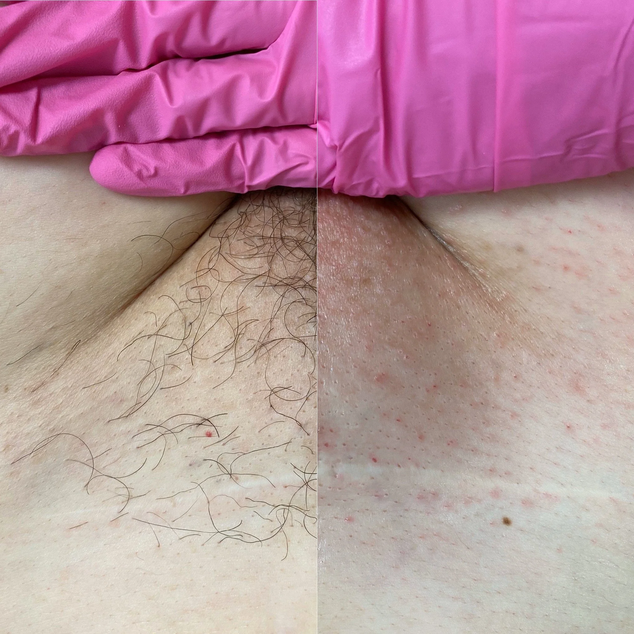 Brazilian Wax in Portland, OR