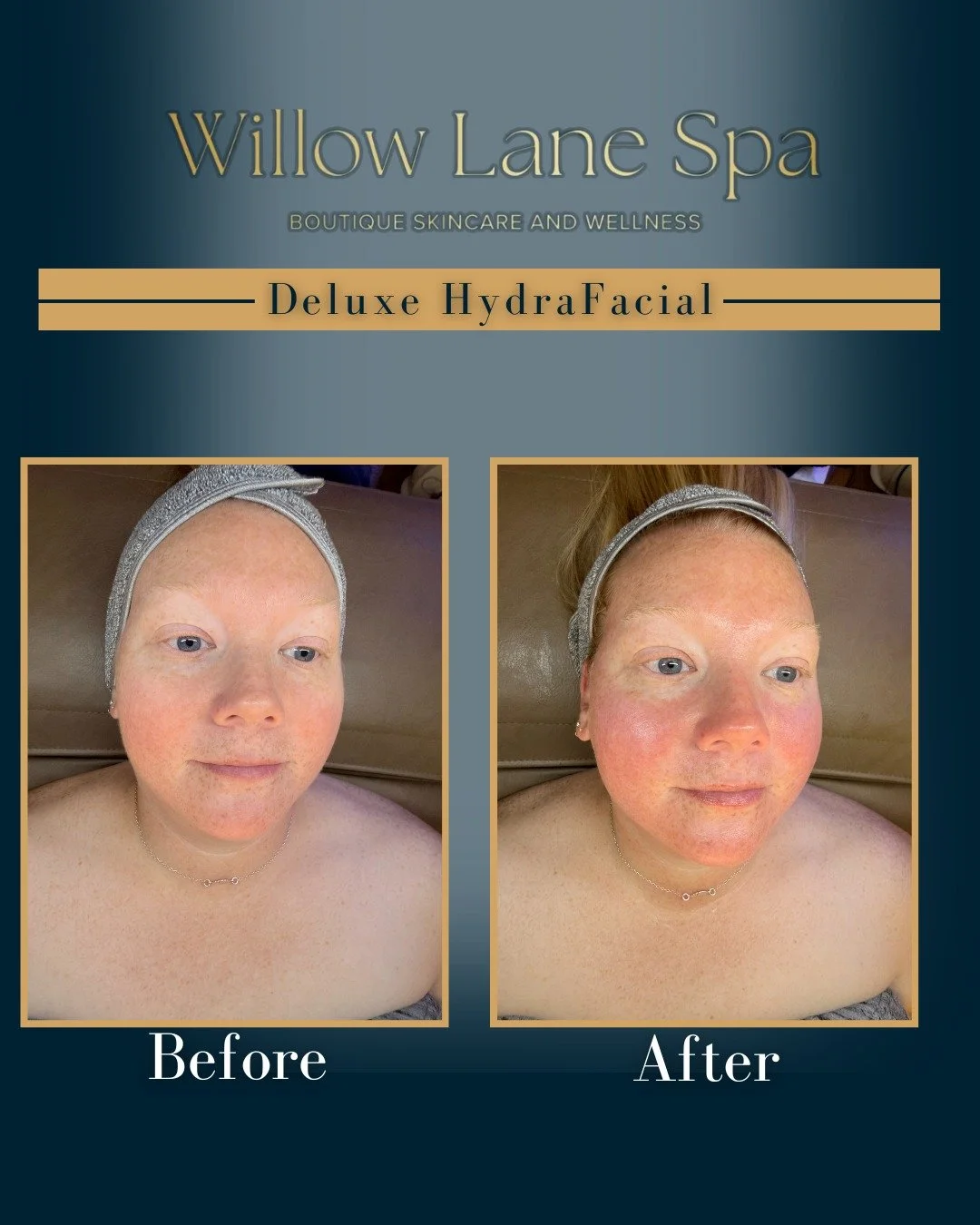 See why our clients are obsessed 😍 

The Deluxe Hydrafacial deeply cleanses, exfoliates, extracts, and infuses the skin for that lit-from-within glow.