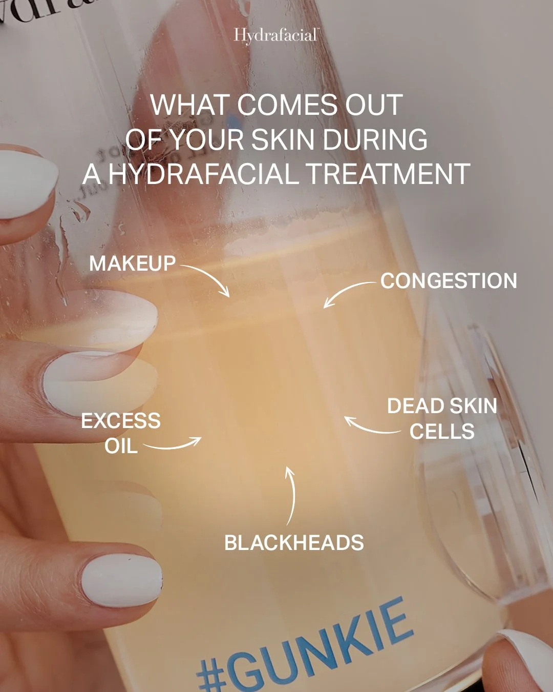 This is what we call the "Gunkie Jar"&mdash;the literal proof of a successful Hydrafacial treatment. It&rsquo;s a mix of everything that was standing between you and your clearest skin: makeup, oil, blackheads, and dead skin.

If you haven'