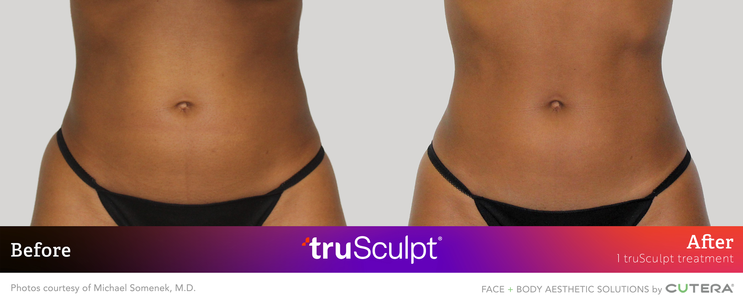 Somenek 1Tx B&A 3.png