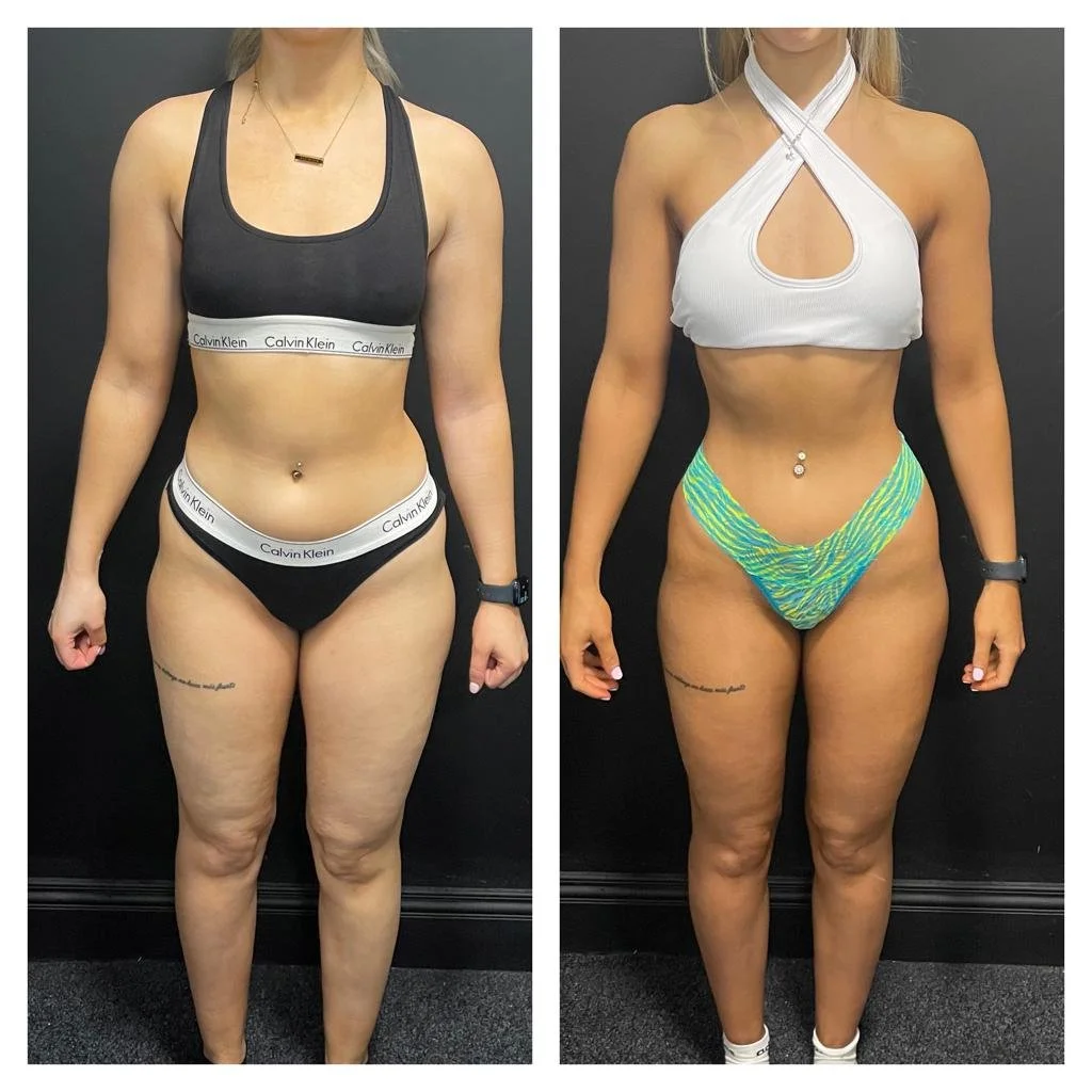 Side-by-side comparison of a woman before and after a fitness transformation, showing weight loss and toned physique, wearing different outfits in each photo.