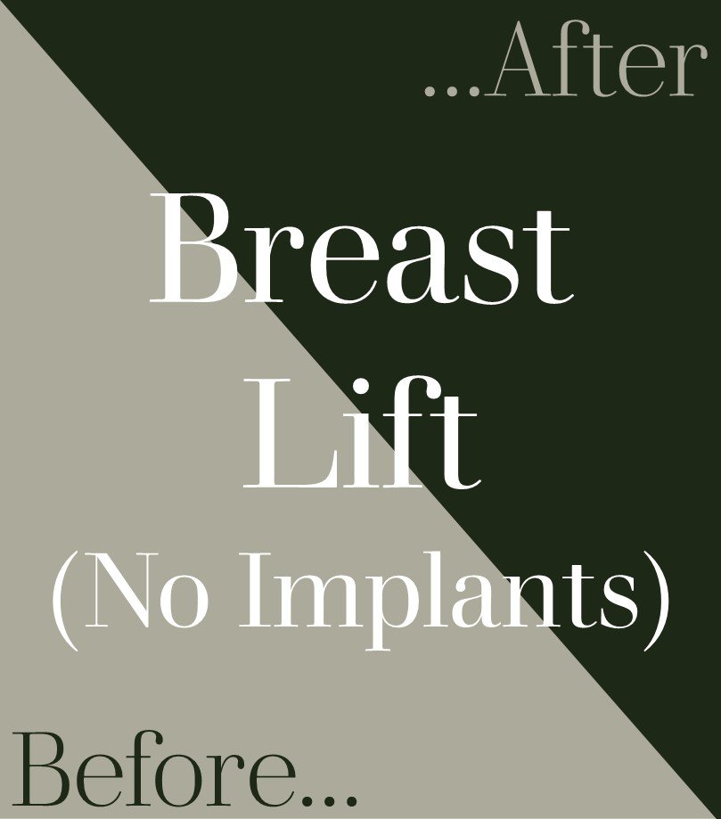 BreastLiftNoI_104 — Bancroft Plastic Surgery