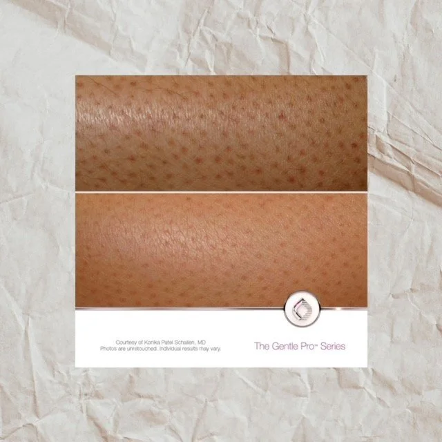 thumbnail_image1 (2).jpg