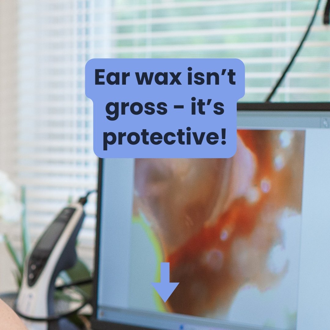 Earwax, or cerumen, traps dust, dirt, and bacteria, keeping your ears clean and safe. Your ears usually clean themselves naturally, so most of the time, no extra cleaning is needed.