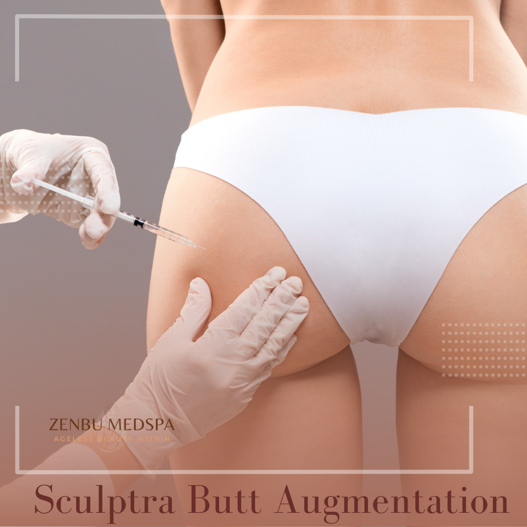 Zenbu-Sculptra.png
