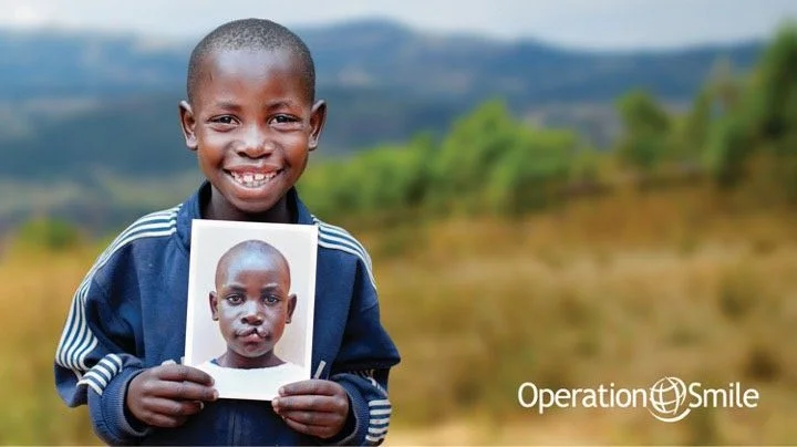 Operation-Smile.jpg