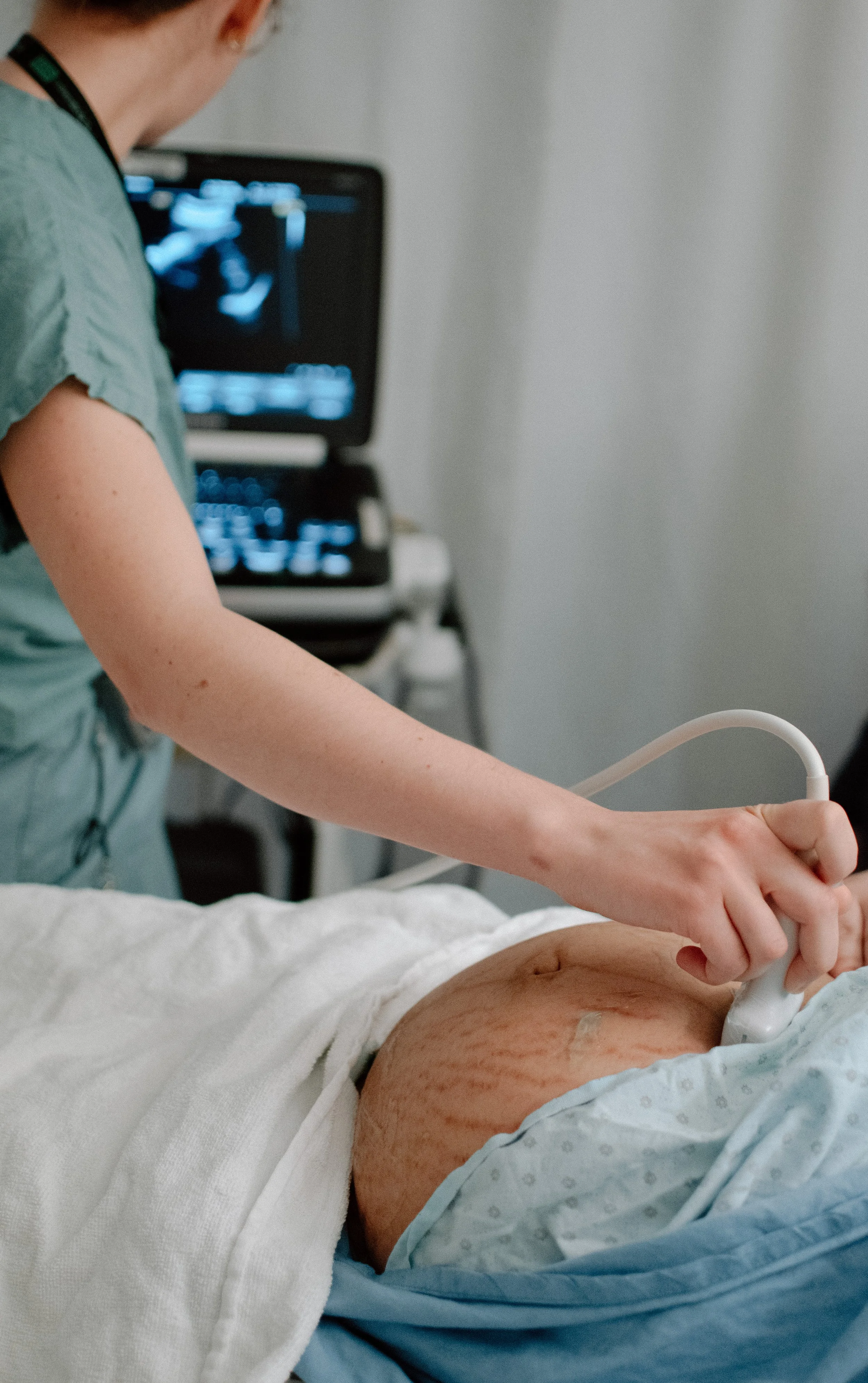 Échographie d'une femme au CHUS sherbrooke