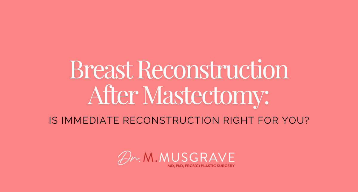 Breast Reconstruction After Mastectomy: Is Immediate Reconstruction Right for You?