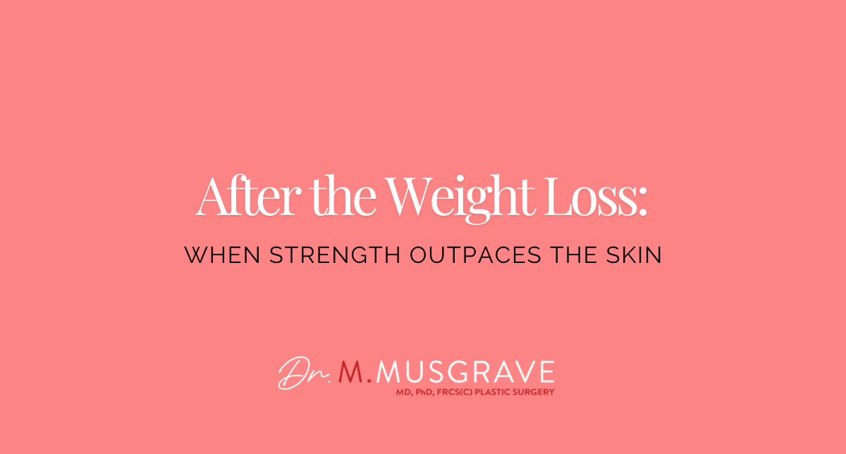 After the Weight Loss: When Strength Outpaces the Skin