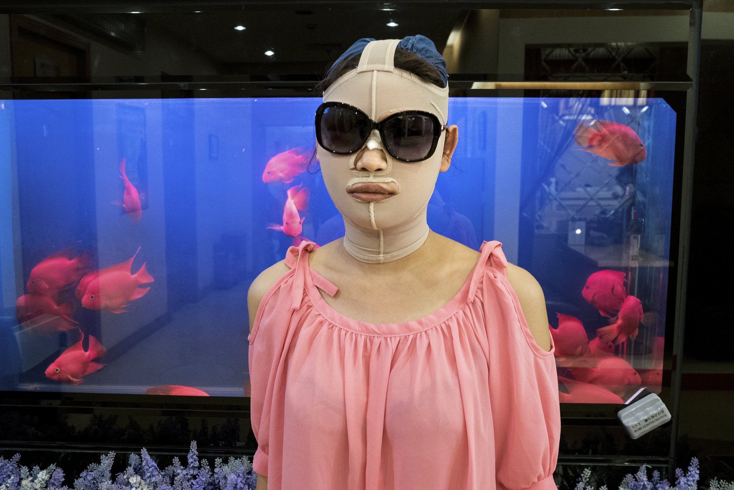 Young lady after cosmetic surgery. Shanghai, China, 2015