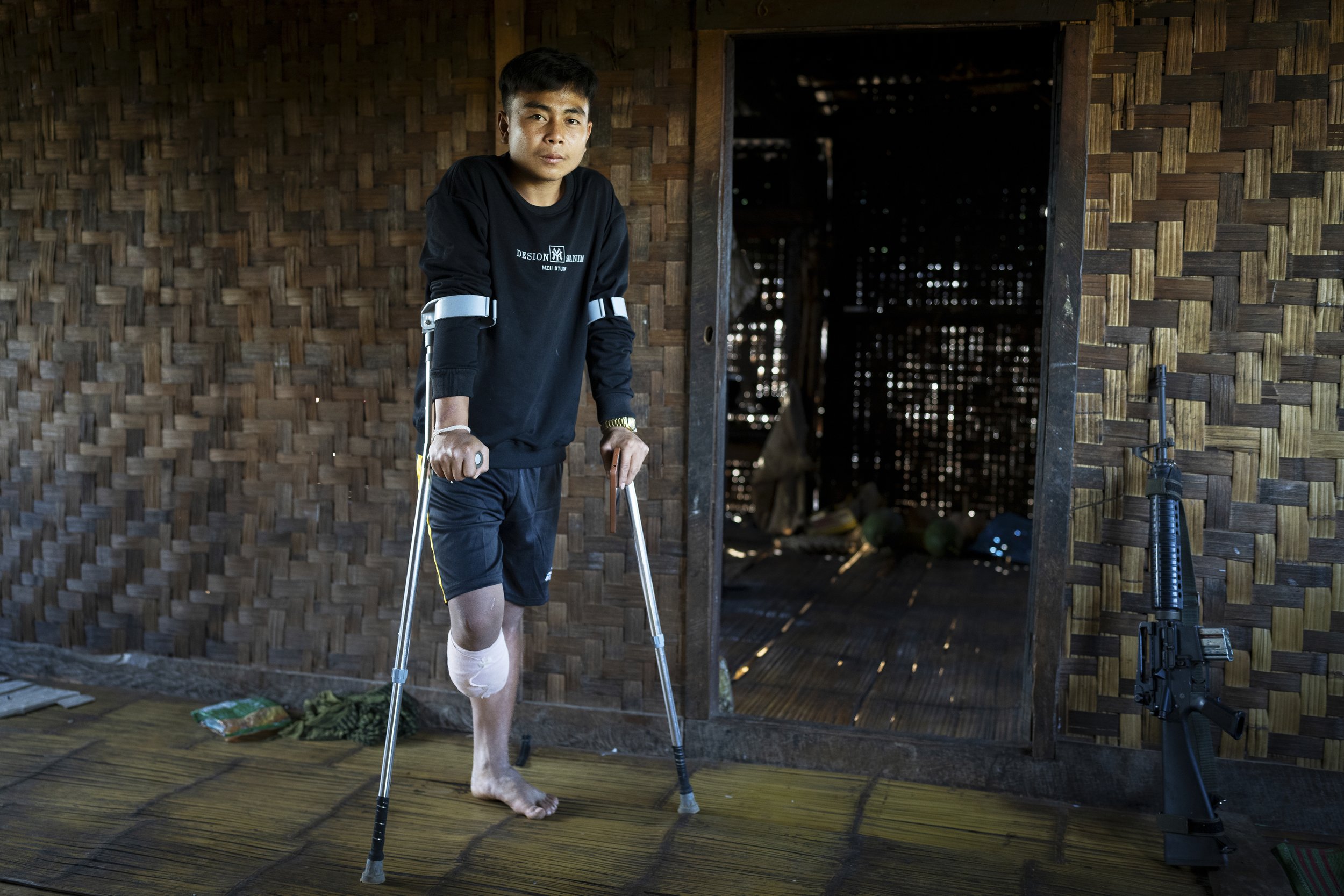Karenni resistance fighter who stepped on a landmine while storming a junta position. Demoso, Myanmar, 2023
