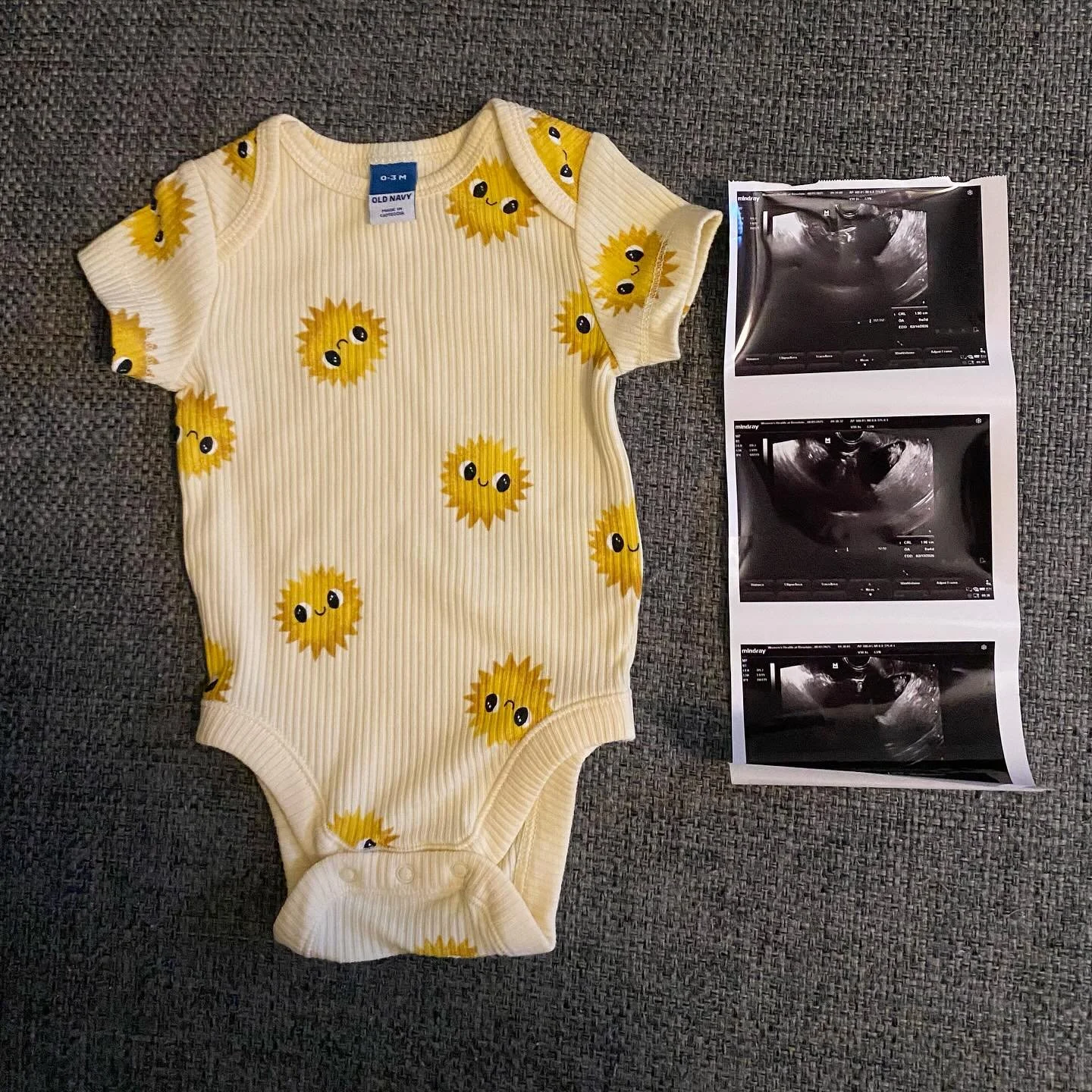 I wanted to post something cute, but nausea has me in shambles. SURPRISE! 🎉

We&rsquo;re over the moon thinking about when we get to hold our sweet little nugget 🥹. He or She will be very loved and spoiled 😅.

Coming Soon - March 2026 ❤️