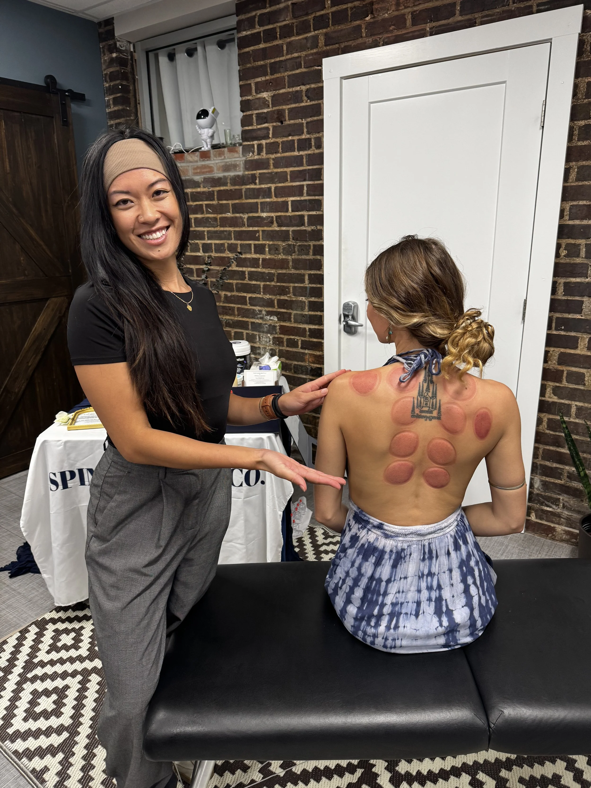 A woman with long dark hair, wearing a beige headband and black shirt, smiling and pointing to a woman's back with cupping marks. The woman with cupping marks is sitting on an examination table, facing away, with curly blonde hair, a tattoo on her up