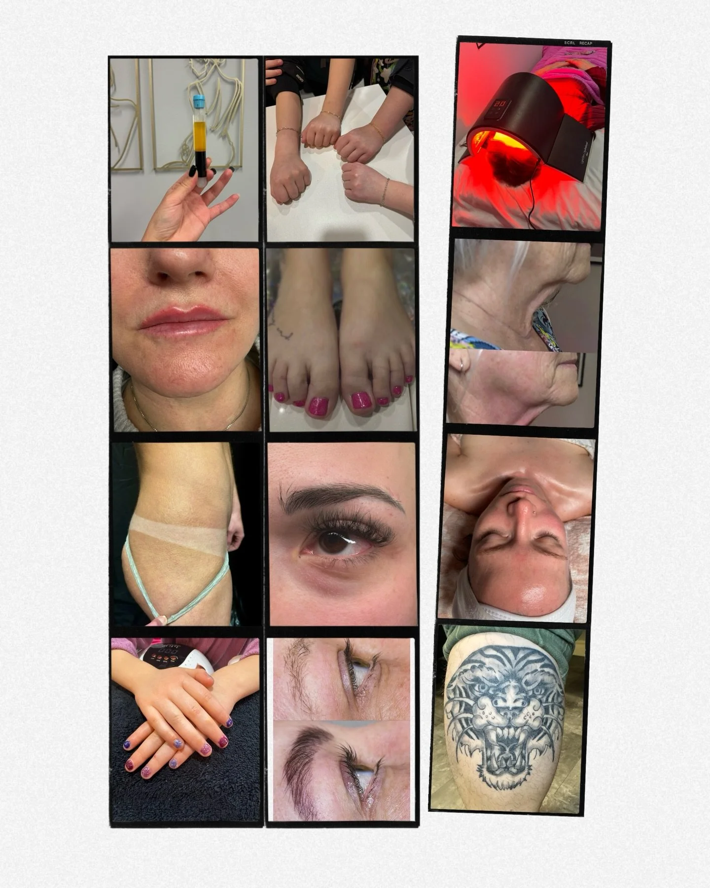 At Glow Aesthetics, there is something for everyone 🫶

Not sure what service is best for you? Book a consult and we can discuss options your options, within your budget. 

📞 587-783-1252
👩&zwj;💻 www.glowbyrita.com 

#skintreatment #medicalaesthet