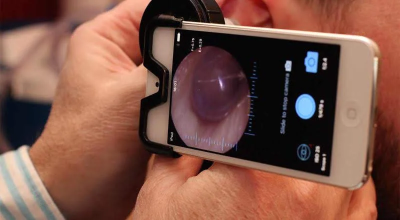 A person holding a smartphone with an otoscope attachment, viewing an ear canal on the phone screen to remove ear wax