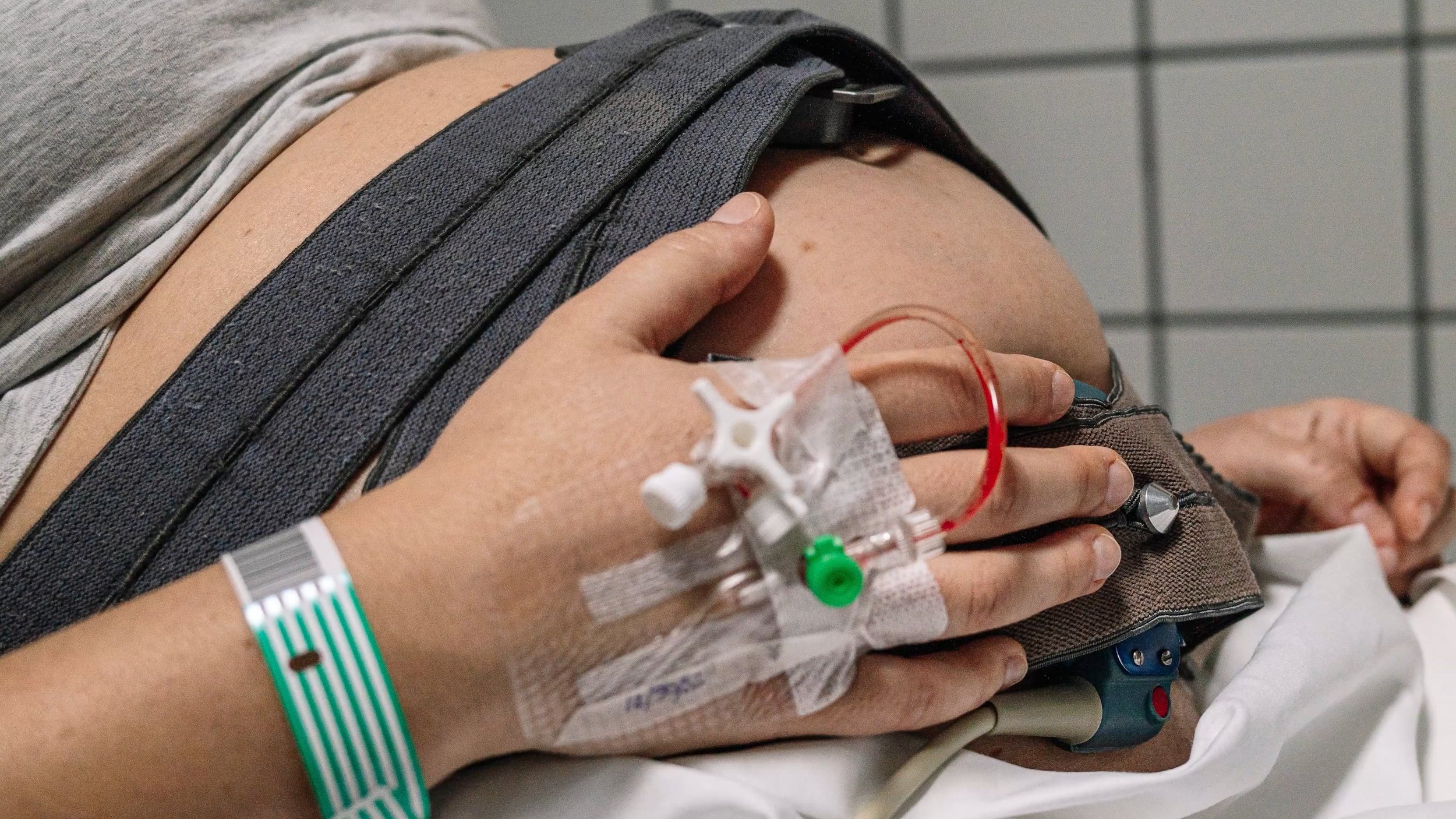 The Truth About Baby Monitors in Labor: How EFM Impacts C-Sections and Your Birth Plan