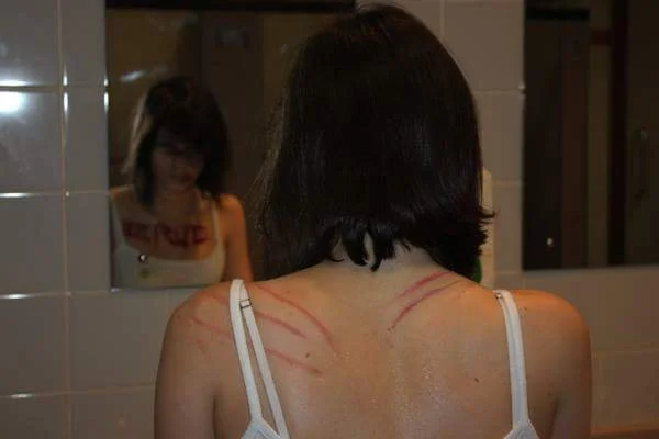 The photo captures a repressed woman awakening as a patient in the Havisham mental asylum, bearing visible scar tissue on her face and neck from a traumatic encounter with a corrupt police officer. Her resistance and threat to expose the officer led 