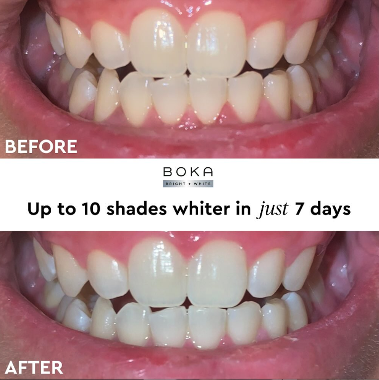 Secured before and after imagery and edited graphic