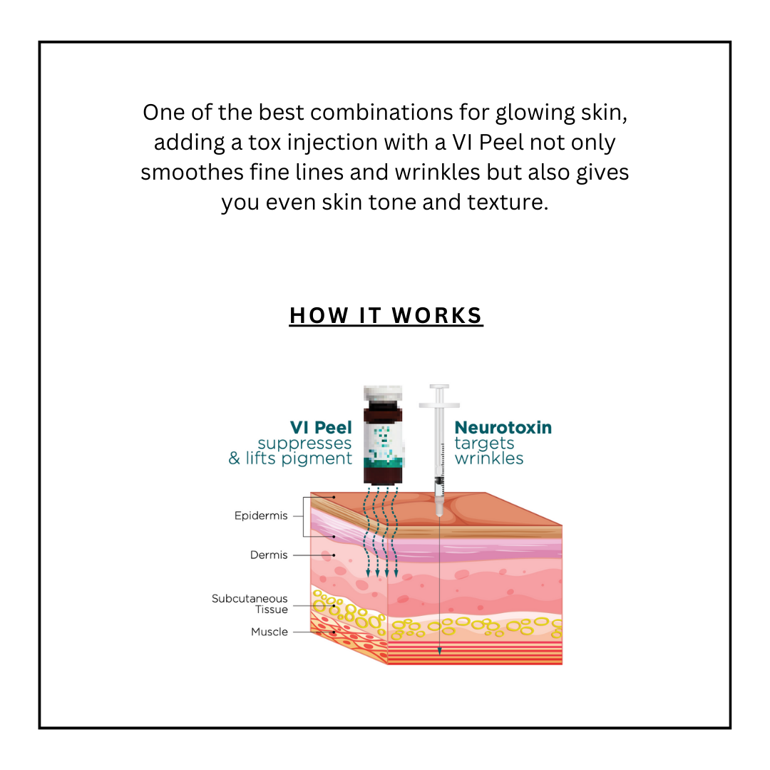 VI Peel and Tox Website (1).png