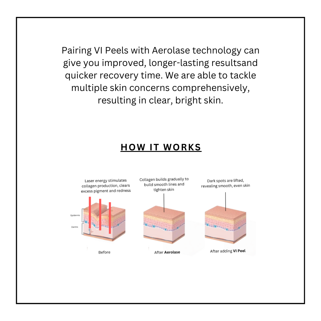 Vi Peel and Aerolase Website (1).png