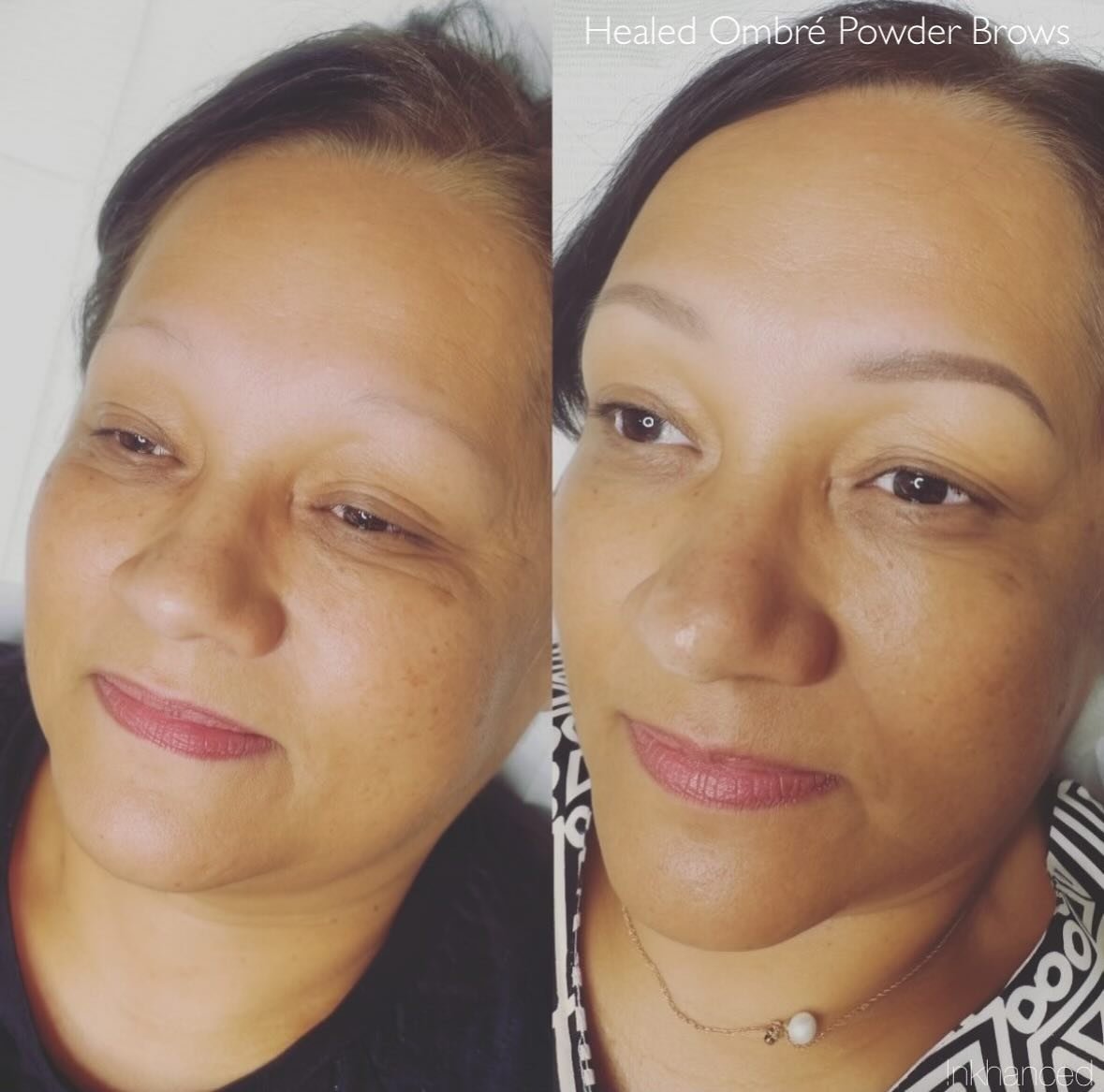 HEALED Ombr&eacute; Powder Brows after one session 🤩

A touch up may be recommended after 4 weeks to build pigment layers safely, adjust shades, enhance details and promote longevity of the cosmetic tattoo. 

For beautiful retention it&rsquo;s impor