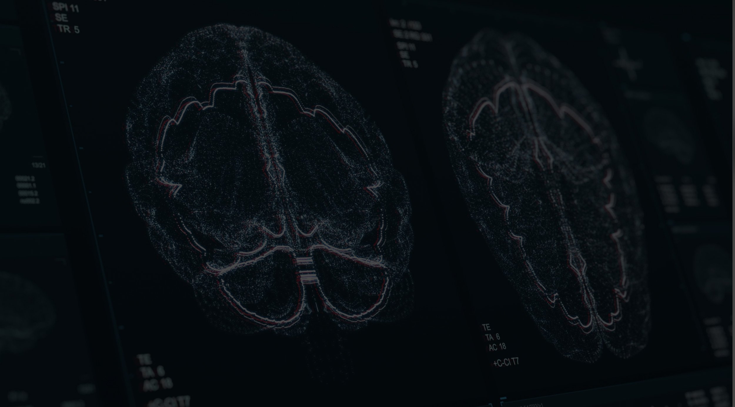 TMS-Treatment-Background.jpg