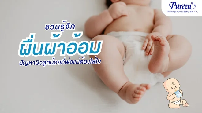 ผื่นผ้าอ้อม ปัญหาผิวลูกน้อยที่พ่อแม่ต้องใส่ใจดูแล