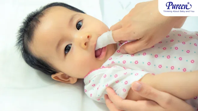 ลิ้นลูกเป็นฝ้าขาว