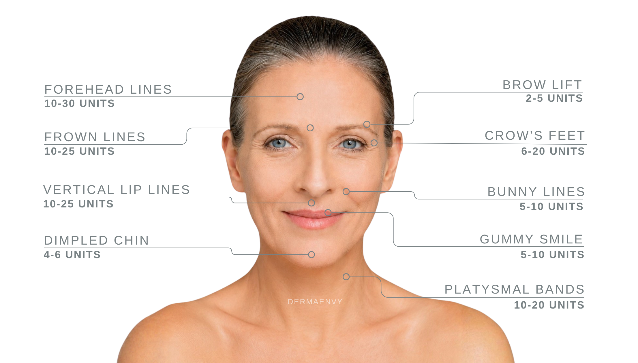 How many units of botox do I need