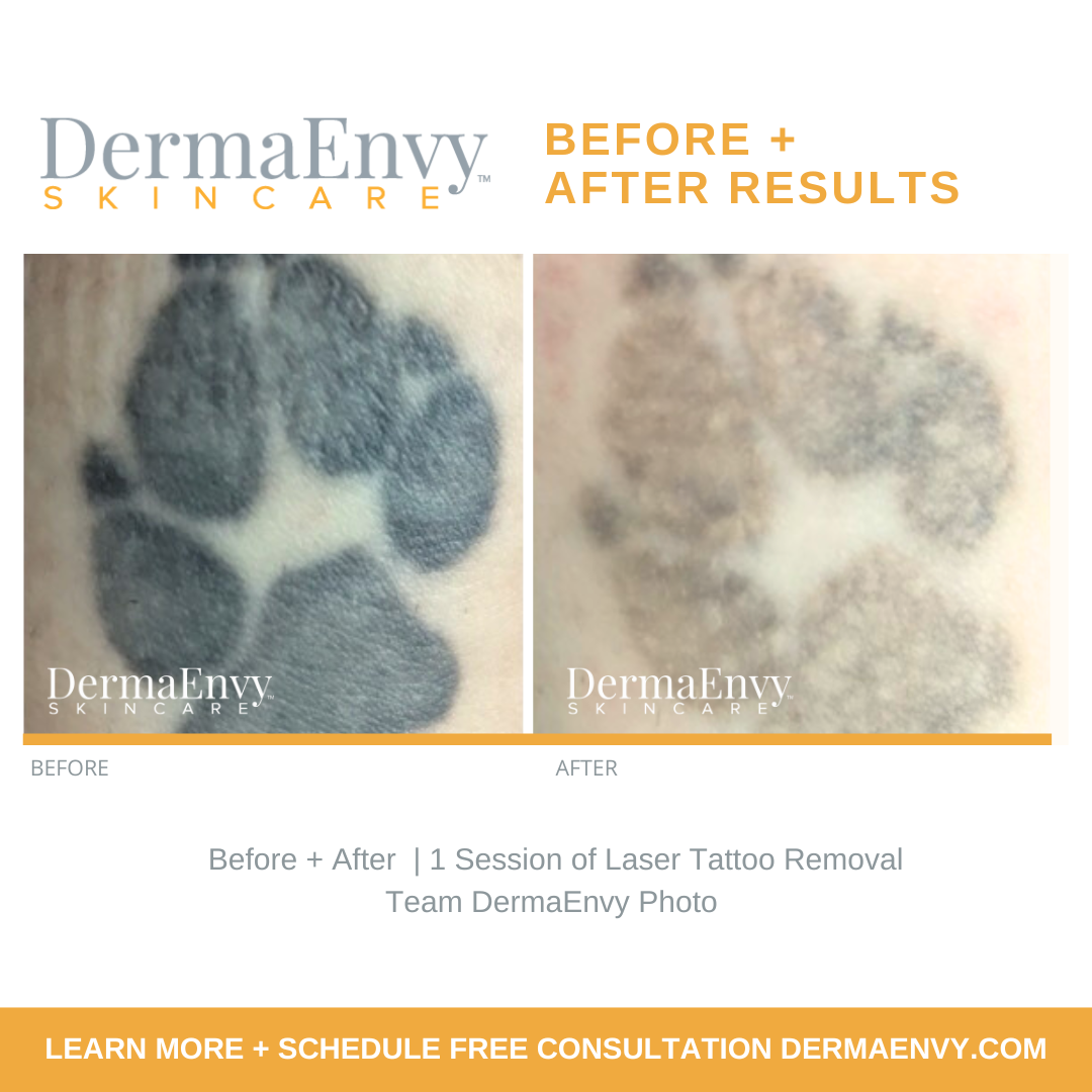 Before and Afters (3).png