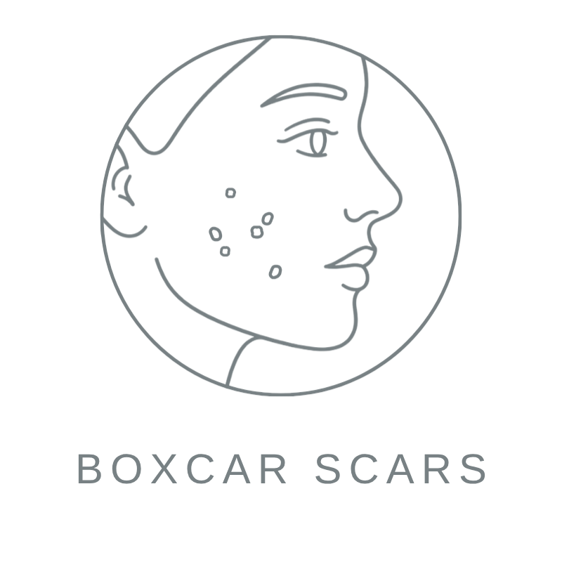 Boxcar Scars