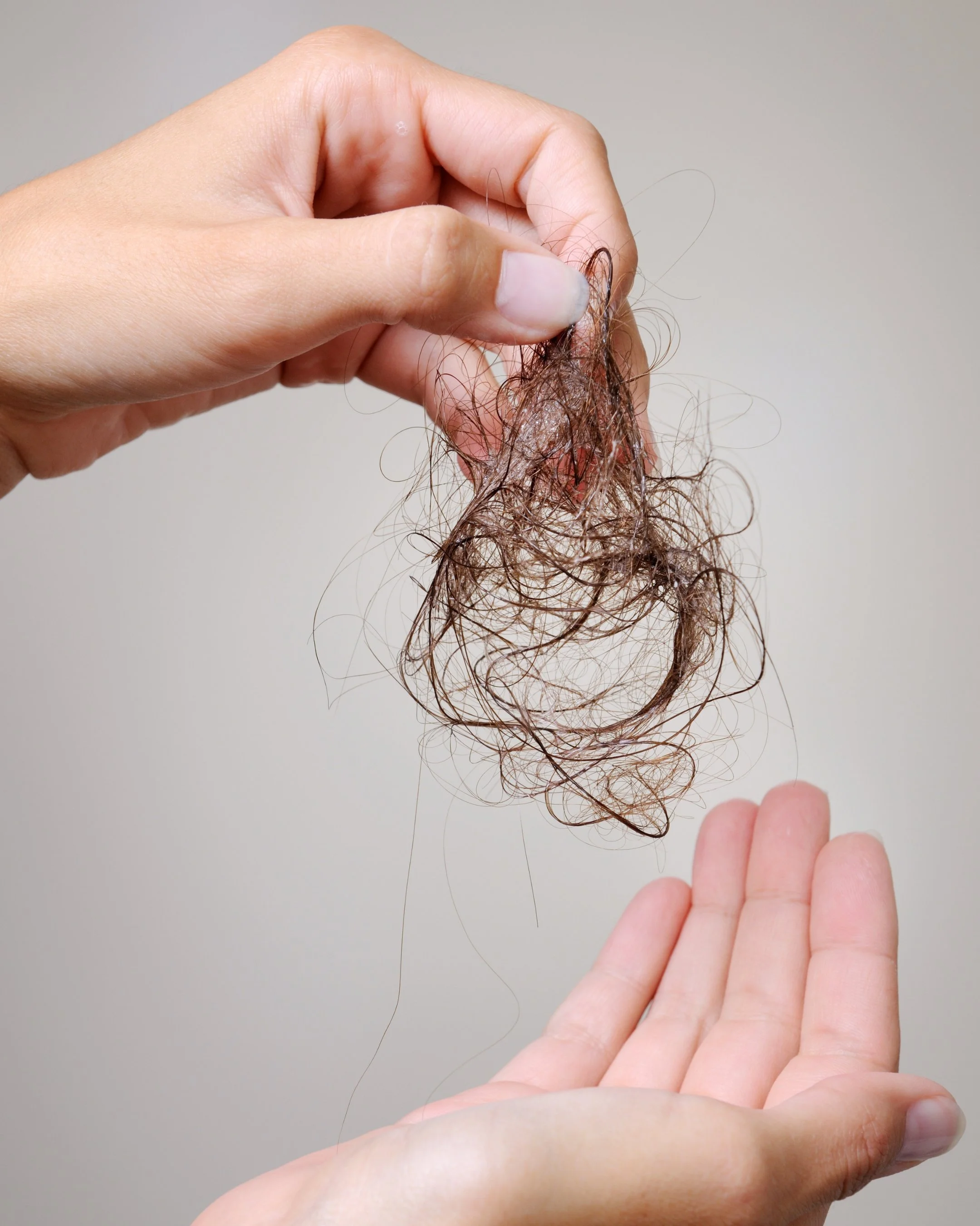 Minoxidil Alternatives for Hair Loss