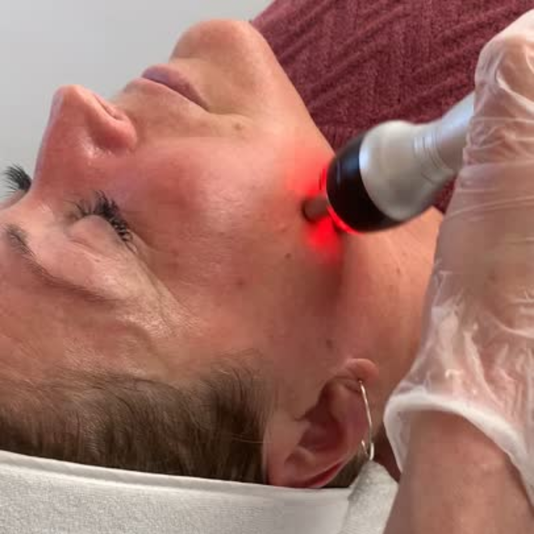 The Science of RF Skin Tightening