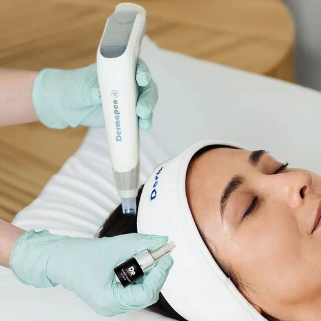 Hair Restoration for Women in Atlantic Canada: Understanding Non-Surgical Solutions for Thinning Hair