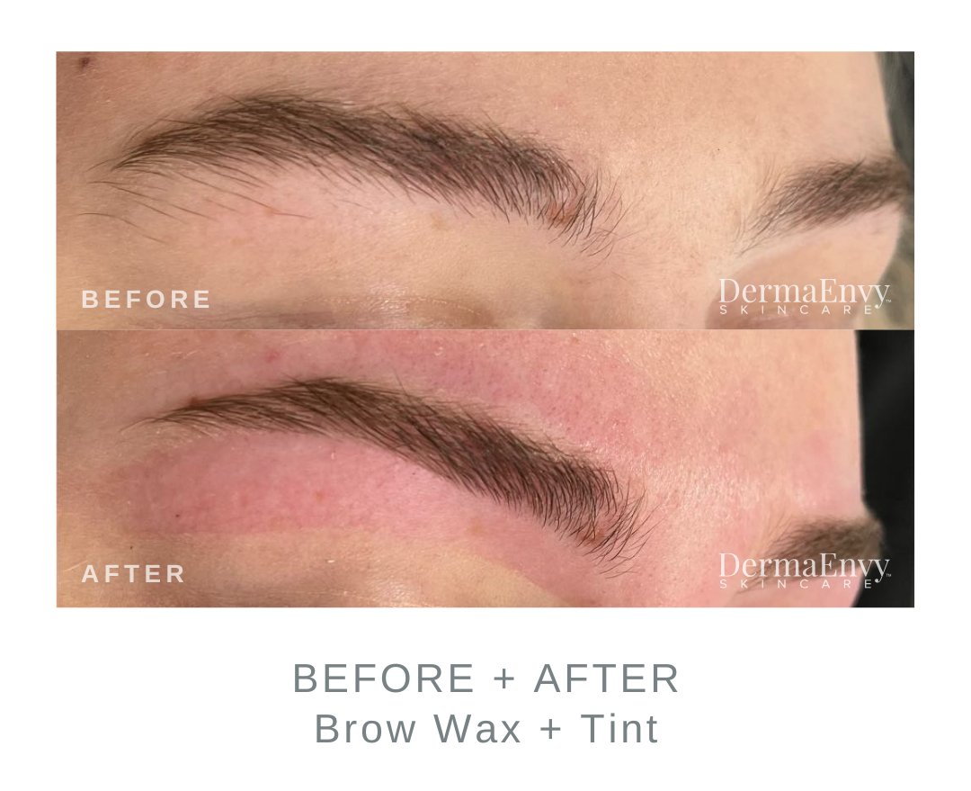 Before and After Brow Wax and Tint | DermaEnvy Skincare