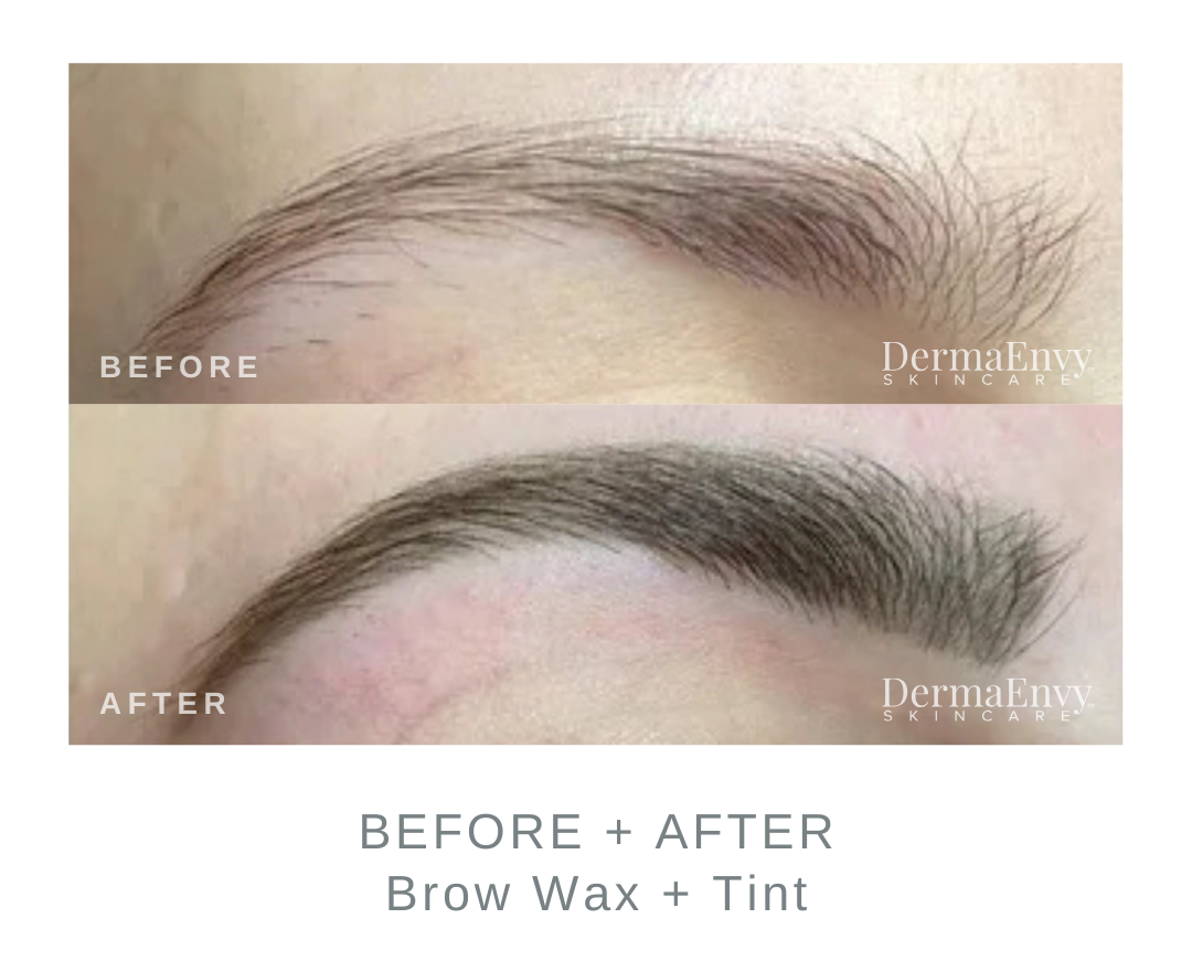 Before and After Brow Wax and Tint | DermaEnvy Skincare