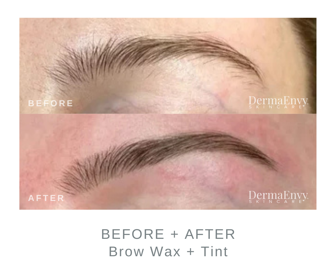 Before and After Brow Wax and Tint | DermaEnvy Skincare