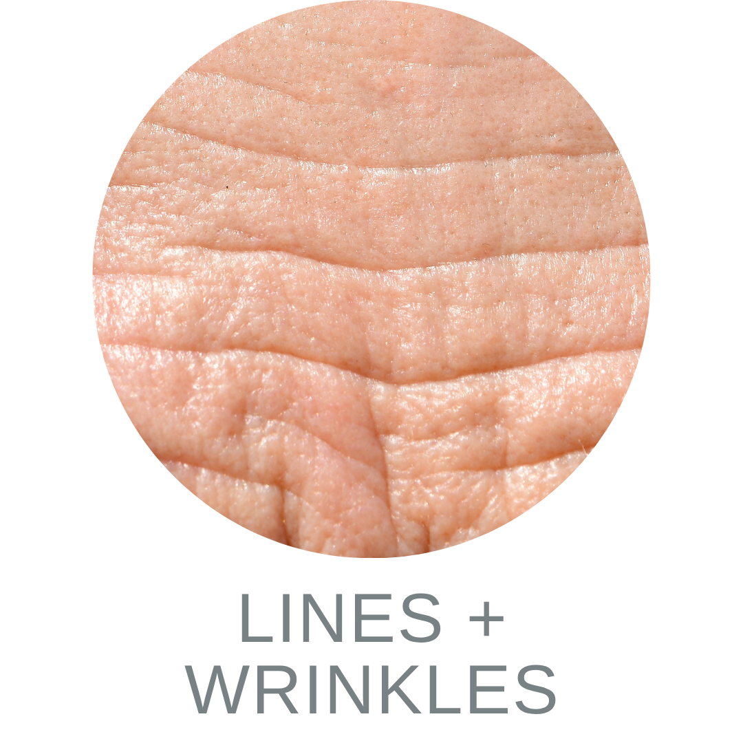Lines + Wrinkles 