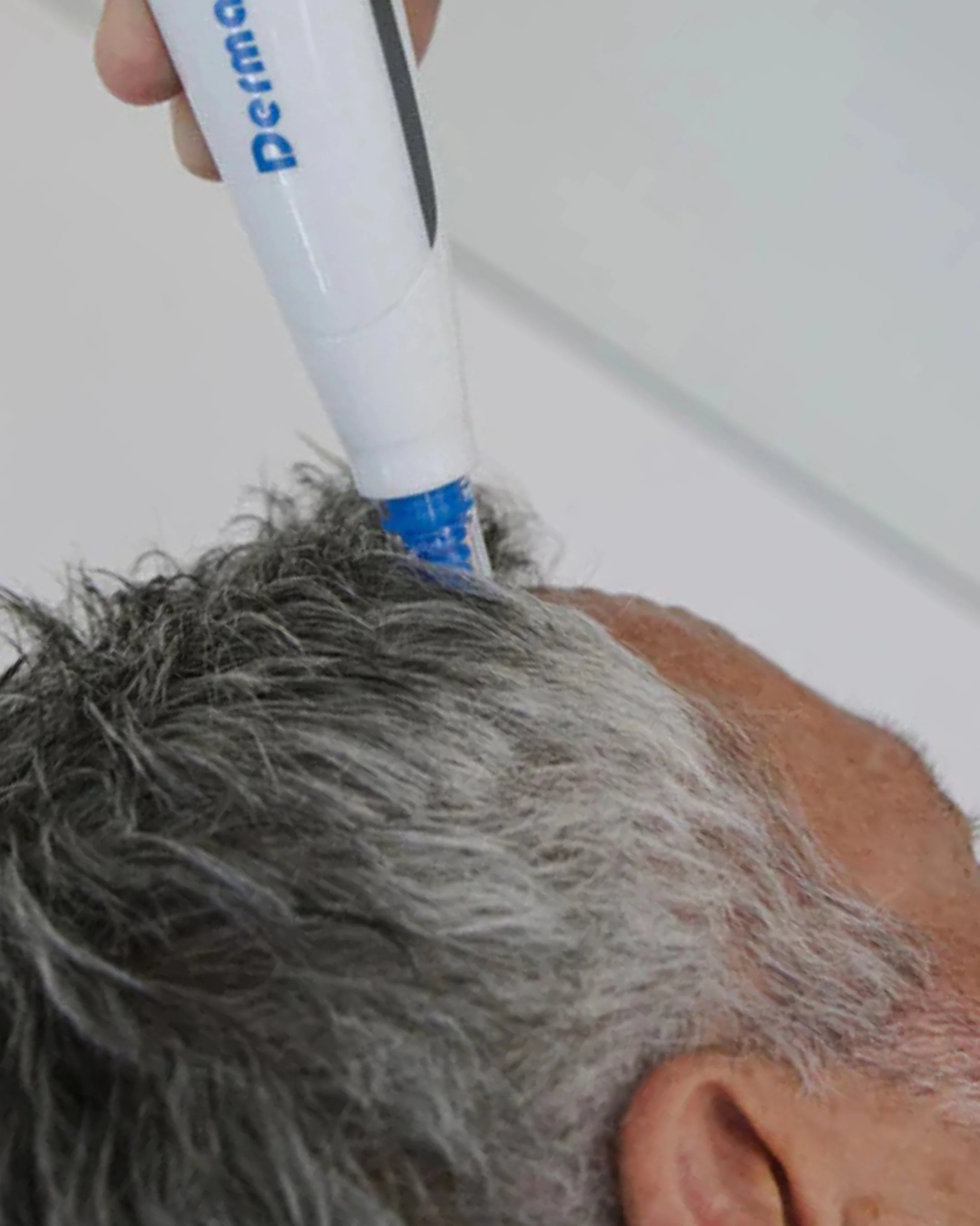 Hair Loss Treatments | DermaEnvy Skincare