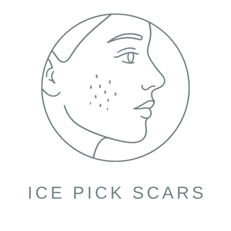 Post-Acne Marks 