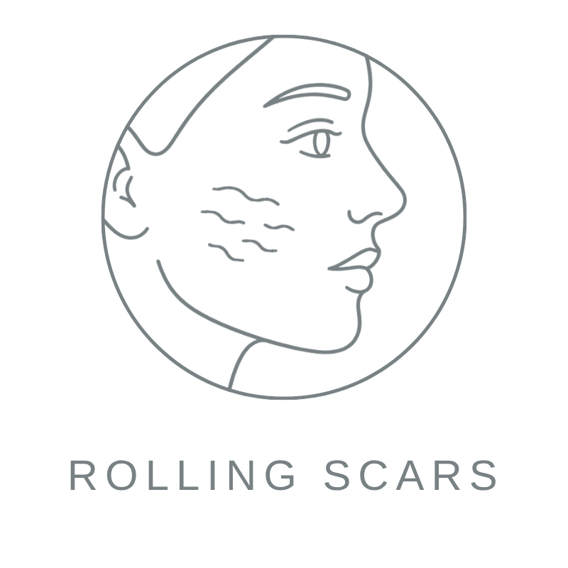 Rolling Scars 