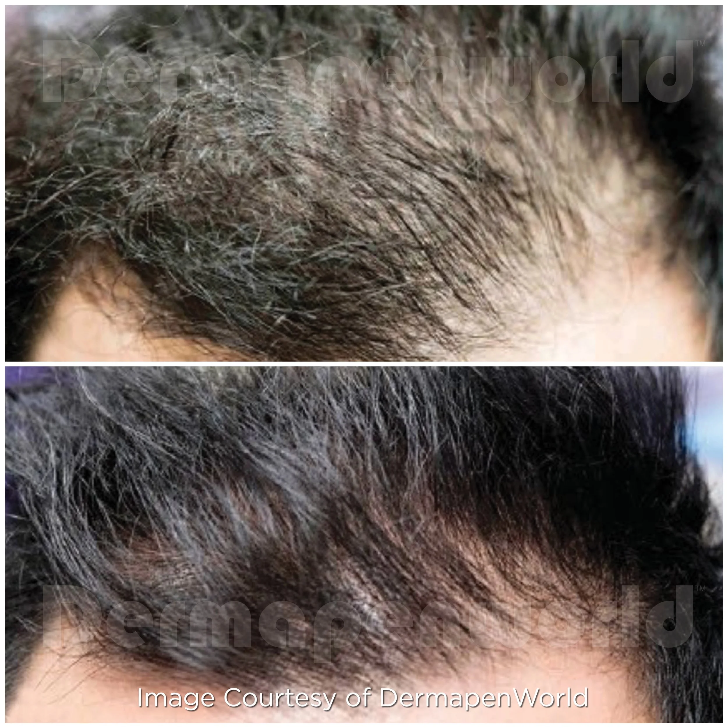 28February_post_EXO_Client 111_Hair_Male.jpg