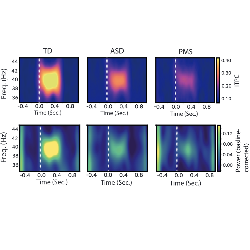 Identifying Phelan-McDermid-Like Electrophysiological Subtypes in Autism Using EEG and Machine Learning
