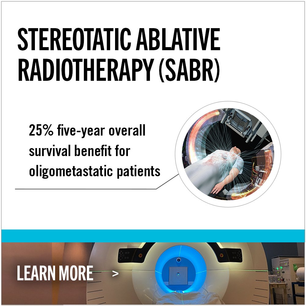 A promotional graphic for stereotactic ablative radiotherapy (SABR) showing a patient on a medical imaging table and a machine emitting radiation beams, with text highlighting a 25% five-year overall survival benefit for oligometastatic patients.